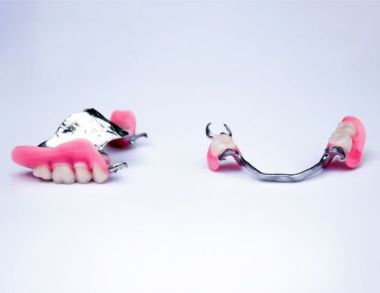 Tipos de prótesis dental