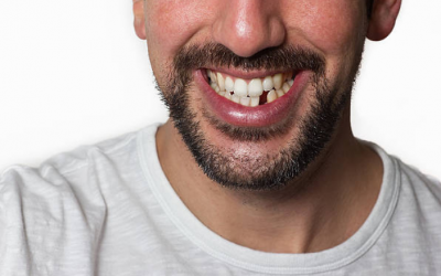 Beneficios de reponer la pérdida de los dientes