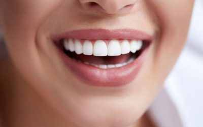 5 recomendaciones para tener los dientes blancos