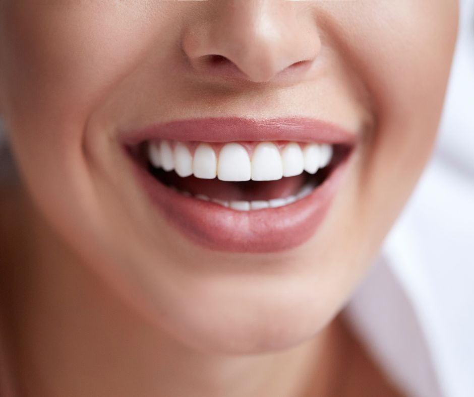 5 recomendaciones para tener los dientes blancos